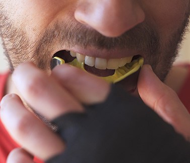 Wearing a mouthguard will protect your teeth from a dental emergency