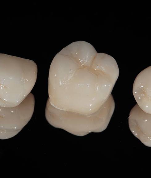 Closeup of dental crowns