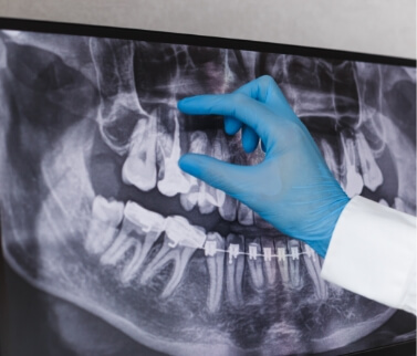 Dentist gesturing to x ray of teeth