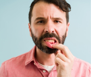 Man pointing to red spot in his gums