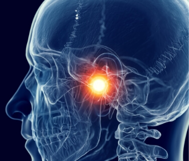 Illustration of head with jaw joints highlighted